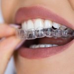 dental-patient-wearing-invisalign dental-patient-wearing-invisalign